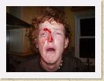 08May05 - rumble wounds in london * After Jess not happy with the party the AmanDA put on for Andy and Nay's unofficial Engagement Party......
Note : The parents of the happy couple will be doing an Offical Engagement party when we arrive home in Australia. 
Note 2 : The parents of the happy couple have just found this out.
.... Jess (aka Dickle's girlie - maybe soon to be...... not saying anything !!!) decided to THROW a PINT of beer (to which it was still full) at Andy's head to try and liven up the party. Well the picture tells the story. Off to hospital for some super glue (literally) and all was good, except for the party to which Jess had ruined for everyone.

******* It so wasn't her fault. Andy called stacks on after we bubbled wrapped Murph up. All the boys ontop of each other and one stray leg knocked the beer out of Jess's hand, only to land on Andy's face. Just cause she has scared me for LIFE, I am not bitter !! * 2272 x 1704 * (2.82MB)